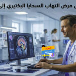 إنفوجرافيك طبي إخباري يظهر طبيبًا في مستشفى سويدي يحلل مسحًا رقميًا للدماغ، مع تصور دقيق لبكتيريا التهاب السحايا المنكورية في الخلفية